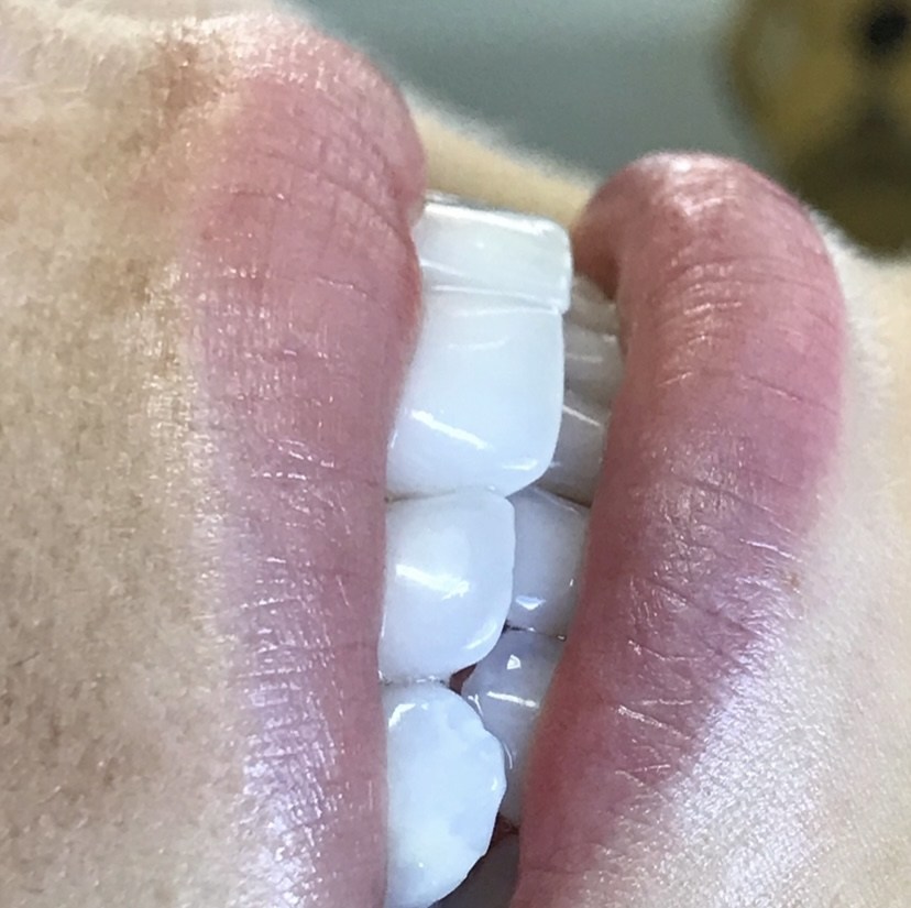 Detalhe de um sorriso com dentes claros